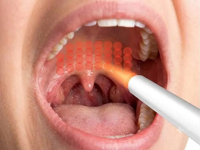 Illustration of laser gently treating the airway